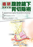 癌研スタイル 腹腔鏡下胃切除術