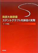 胸部大動脈瘤ステントグラフト内挿術の実際